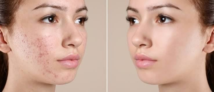 A Guide to Women’s Scar Treatment and Skin Care